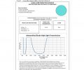 Alexandrite/Diode High Light Transmission - Model #33-BK - Image 3
